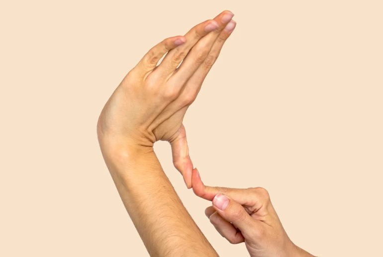 دکتر سندرم مارفان - شیراز