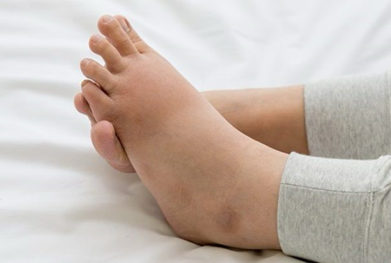 دکتر ورم پا - ( بندرعباس )